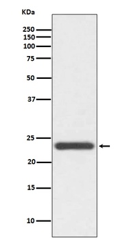 HE4 WFDC2 Rabbit Monoclonal Antibody