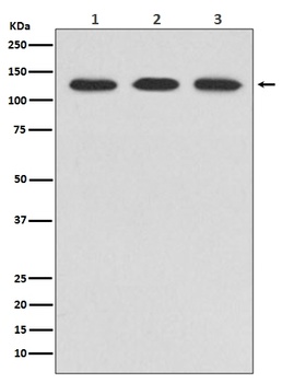 ABL2 Rabbit Monoclonal Antibody
