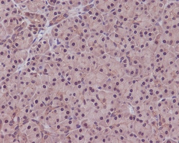 PPP1CA+PPP1CB/PPP1CA Rabbit Monoclonal Antibody