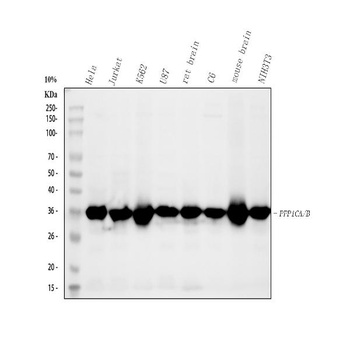 PPP1CA+PPP1CB/PPP1CA Rabbit Monoclonal Antibody