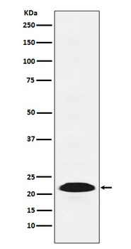 PSB9/LMP2 Rabbit Monoclonal Antibody