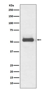 TRK fused gene TFG Rabbit Monoclonal Antibody