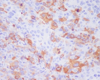 TACC3 Rabbit Monoclonal Antibody