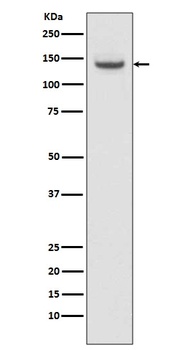 TACC3 Rabbit Monoclonal Antibody