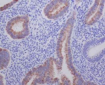 AGR2/Ag 2 Rabbit Monoclonal Antibody