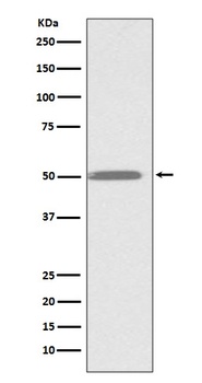 ILK/Integrin Linked Ilk Rabbit Monoclonal Antibody