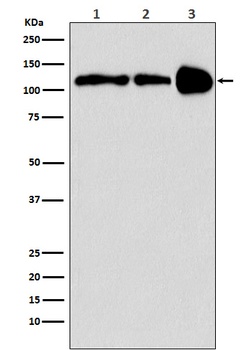 PGC1 beta PPARGC1B Rabbit Monoclonal Antibody