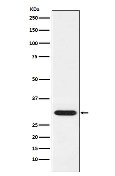 GCLM Rabbit Monoclonal Antibody
