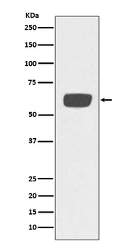 PLAT/Tpa Rabbit Monoclonal Antibody