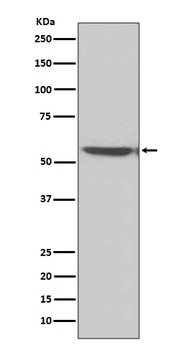 Calcineurin A Rabbit Monoclonal Antibody