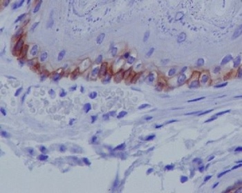Collagen XVII Rabbit Monoclonal Antibody