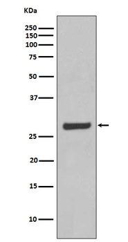 AQP5 Rabbit Monoclonal Antibody