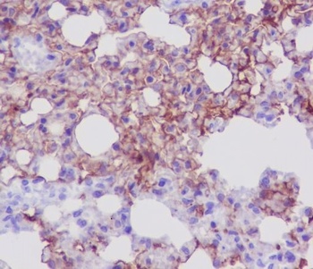 AQP5 Rabbit Monoclonal Antibody