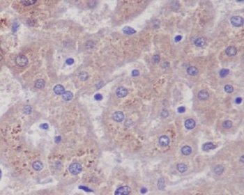 Glutamine Synthetase GLUL Rabbit Monoclonal Antibody