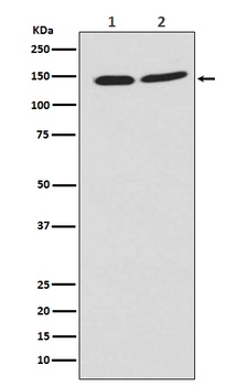 PHF8 Rabbit Monoclonal Antibody