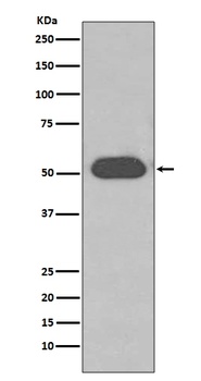 GC / VDBP Rabbit Monoclonal Antibody