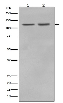 RNF20 Rabbit Monoclonal Antibody