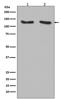 RNF20 Rabbit Monoclonal Antibody