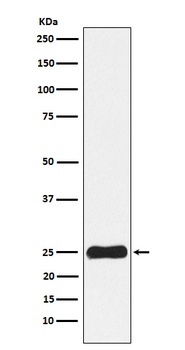 Casein Kinase 2 beta Rabbit Monoclonal Antibody