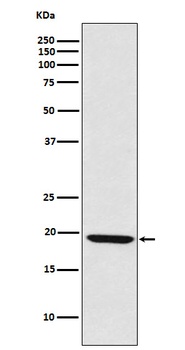 LMO2 Rabbit Monoclonal Antibody