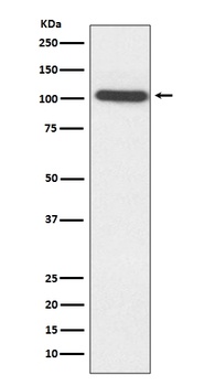 ACTN2 Rabbit Monoclonal Antibody