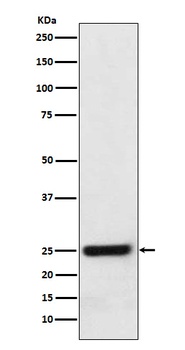 ERAB Rabbit Monoclonal Antibody
