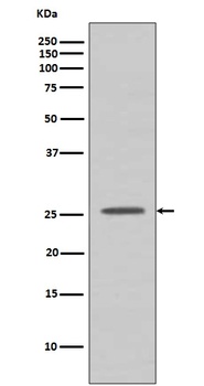 BCL2A1/Bcl 2 Related Protein A1 Rabbit Monoclonal Antibody