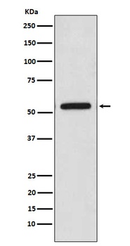 CaMKII Rabbit Monoclonal Antibody