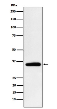 Pyruvate Dehydrogenase E1 beta subunit PDHB Rabbit Monoclonal Antibody
