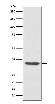 LYVE1 Rabbit Monoclonal Antibody
