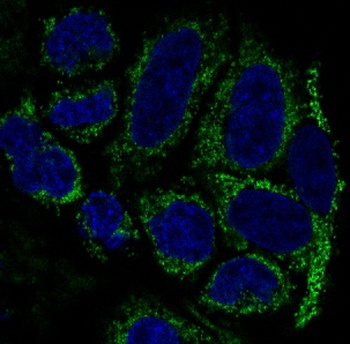 TOMM20/Tom20 Rabbit Monoclonal Antibody