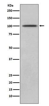 CD10 MME Rabbit Monoclonal Antibody