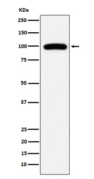 CD10 MME Rabbit Monoclonal Antibody