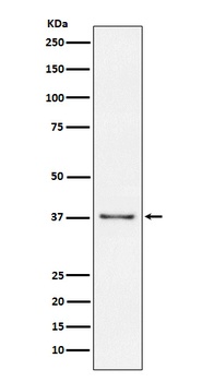 CD23 FCER2 Rabbit Monoclonal Antibody