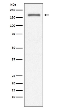 CD11a ITGAL Rabbit Monoclonal Antibody