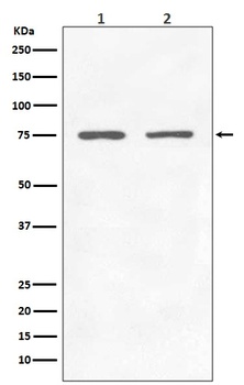 GARS Rabbit Monoclonal Antibody