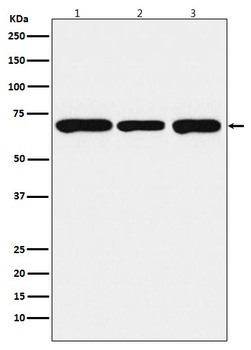 PCK2 Rabbit Monoclonal Antibody