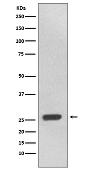 UCHL3 Rabbit Monoclonal Antibody