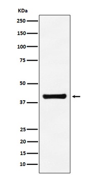 Aldolase ALDOA Rabbit Monoclonal Antibody