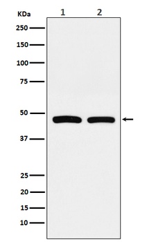 FDFT1 Rabbit Monoclonal Antibody