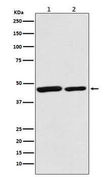 Citrate synthetase CS Rabbit Monoclonal Antibody