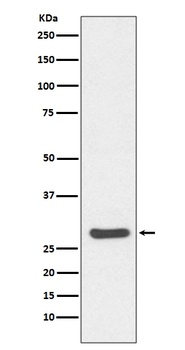 Caspase-14/14 Rabbit Monoclonal Antibody