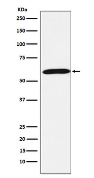 Calsequestrin 1 Rabbit Monoclonal Antibody