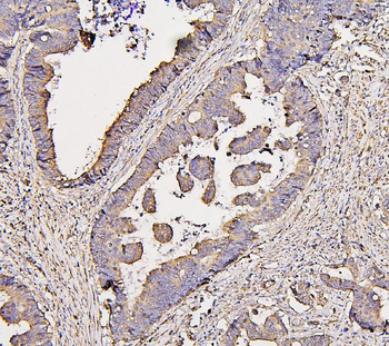 COX IV COX4I1 Antibody (monoclonal, 4G11)