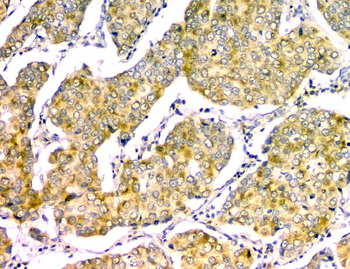 GM130 GOLGA2 Mouse Monoclonal Antibody