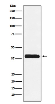 Glycophorin C GYPC Rabbit Monoclonal Antibody