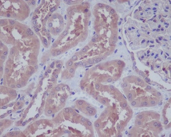 HAPLN1 Rabbit Monoclonal Antibody