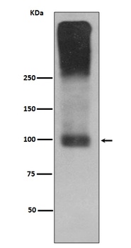 mGluR2 GRM2 Rabbit Monoclonal Antibody
