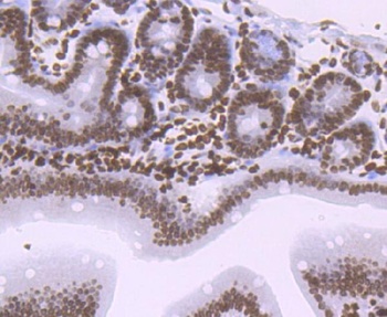 Histone H1.2/H1 Rabbit Monoclonal Antibody