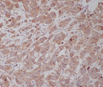 Tubulin gamma Rabbit Monoclonal Antibody